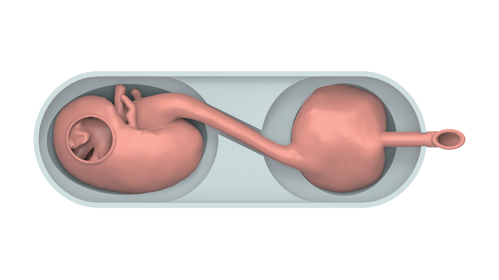 Simulator of Cystoscope Operation